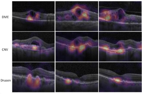 1519697714206036440.jpg W020180226316970371291.jpg