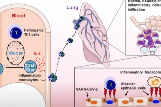 How to use Tocilizumab to reduce mortality of severe patients?