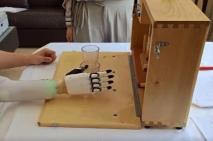 Chinese medical researchers develop AI hand to aid disabled