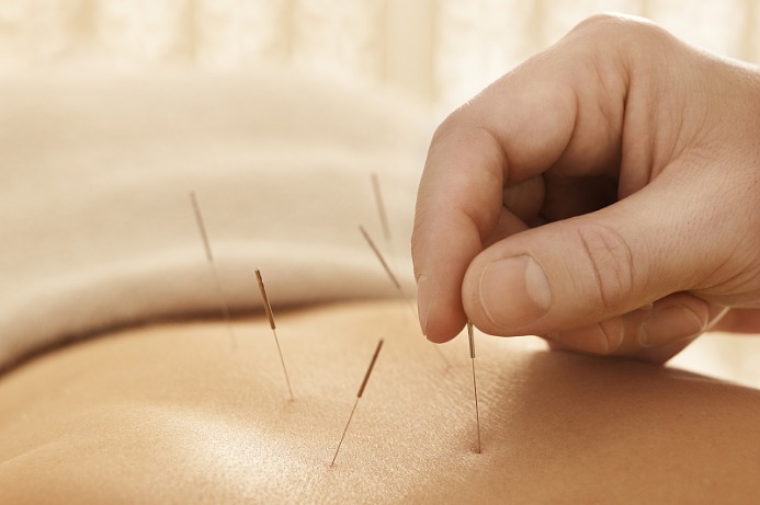 Chinese acupuncture reduces pain, anxiety in cancer surgery: Study