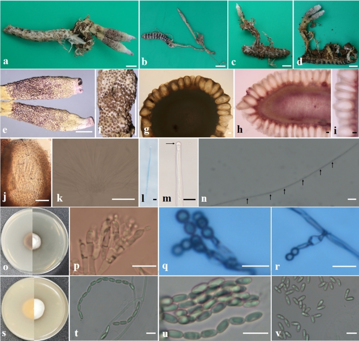 New species discovered in Zhoushan