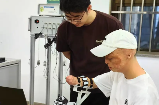 Burn survivor enrolls in Nanjing, attempting to create robotic hand